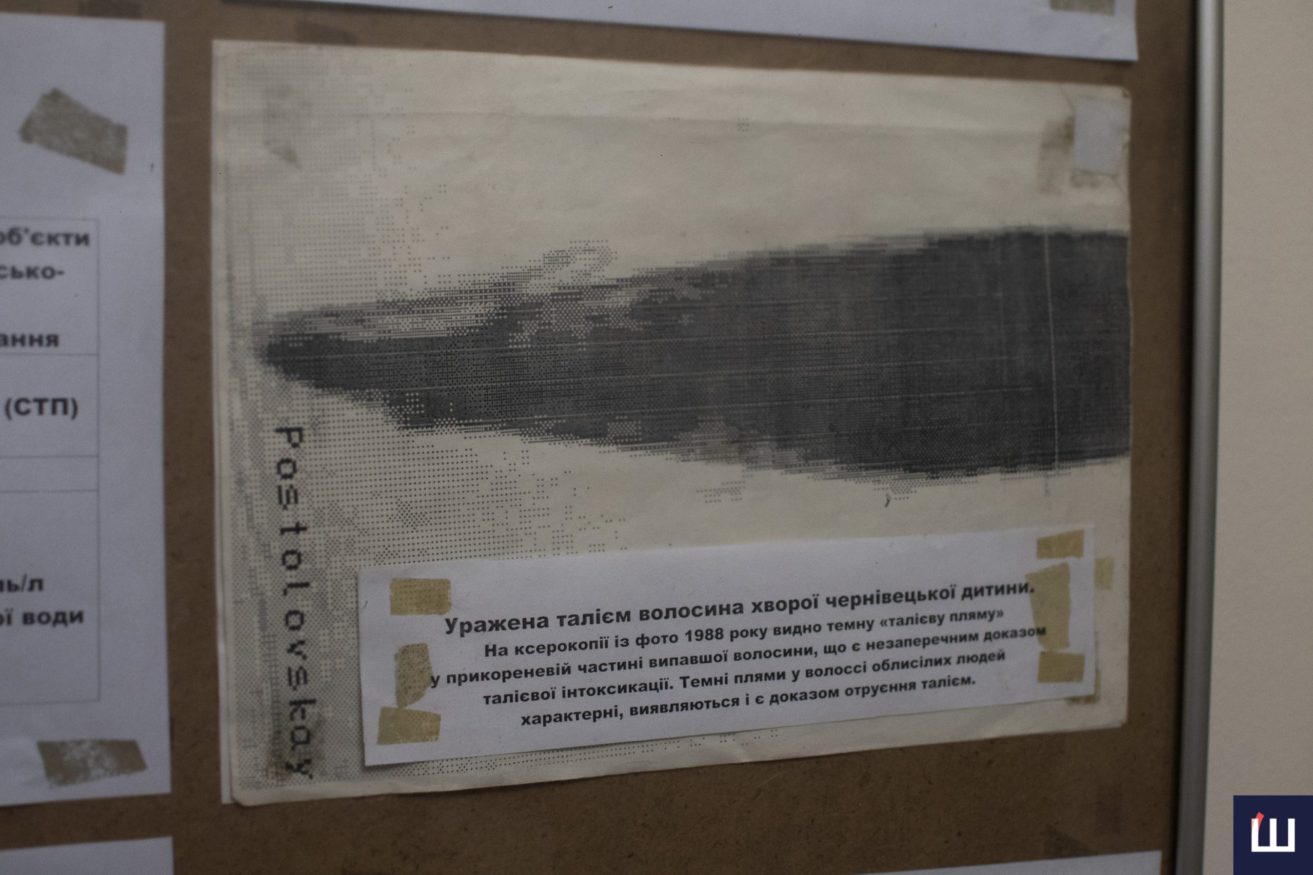 Ракетне паливо «розлили» у кабінетах КДБ чи на одній з вулиць: яка причина облисіння дітей у 80-х у Чернівцях