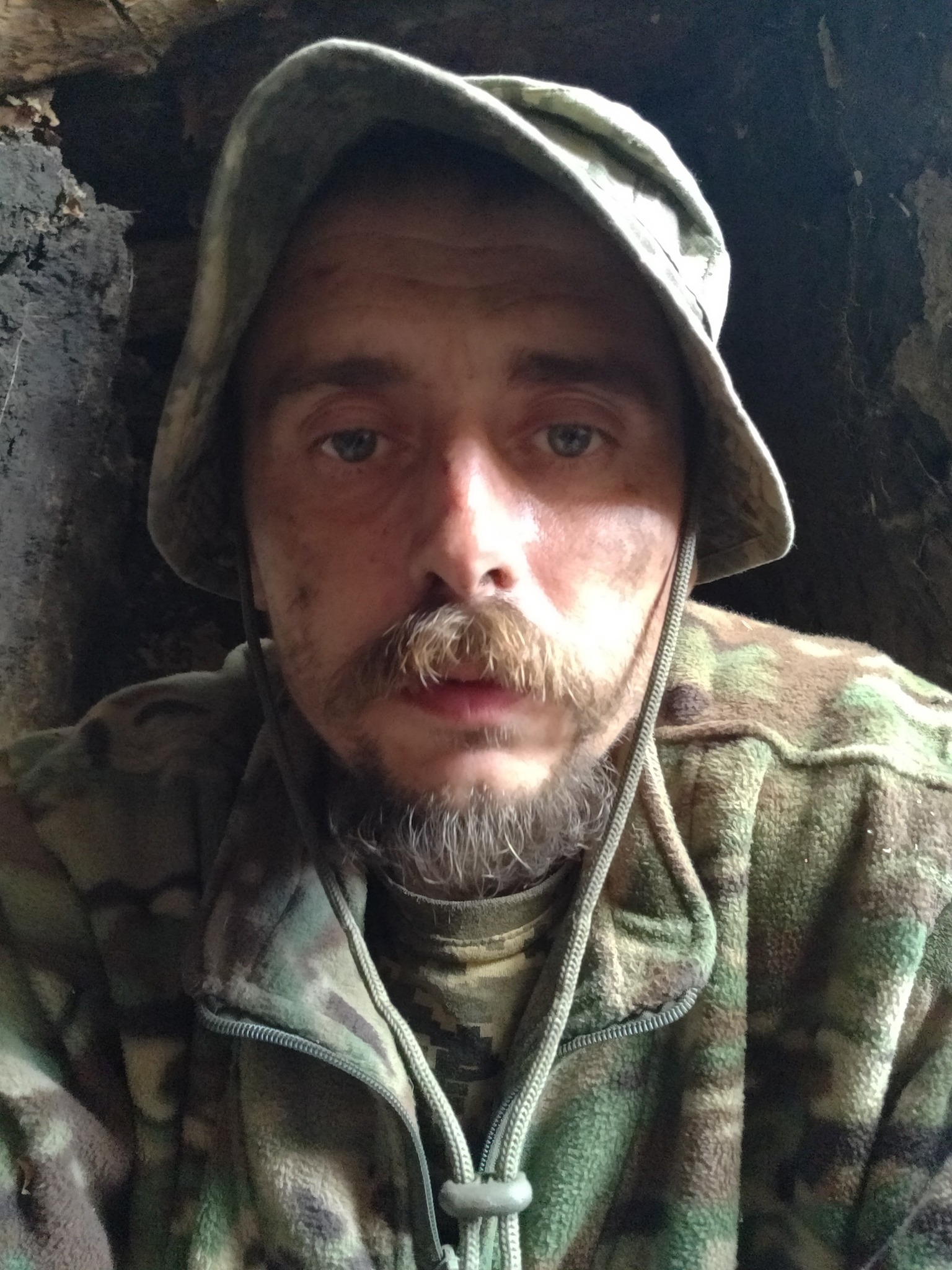 У Чернівцях збиратимуть кошти для пораненого фотожурналіста Ігоря Константинюка
