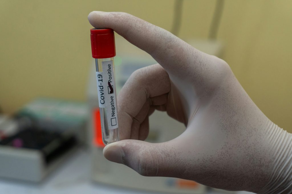 У Чернівецькій області продовжує зростати кількість хворих на COVID-19