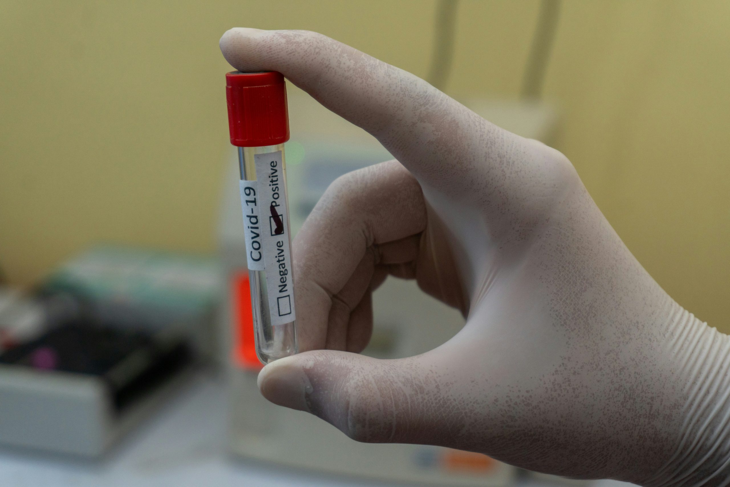 У Чернівецькій області продовжує зростати кількість хворих на COVID-19